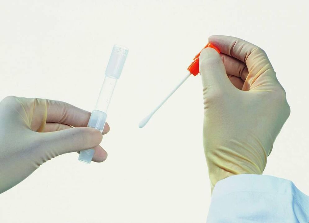 Analysesammlung zur Erkennung chronischer Prostatitis