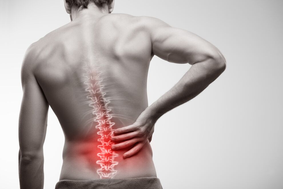 Schmerzen im Kreuzbein ein Zeichen einer chronischen Prostatitis